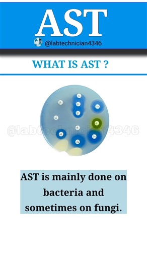 AST|Antimicrobial susceptibility testing|Microorganism|antibiotic|diskdiffusion|brothdilution|E-test