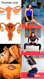#infertility #infertilityawareness #cyst #weightloss #weightlossjourney #pcodproblem #pcos #irregularperiods #fitnessjourney | Laxmi Patel