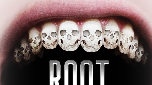 Root Cause - Apple TV