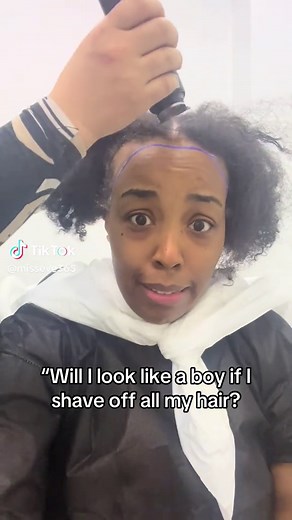 #fyp #hairtransformation #edgesonfleek #hairloss #hairgrowth #hairtransplant #hevaclinic #hairtransplant