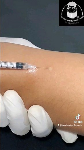 Inyección intradermica 🩺✅️ #enfermeria #estudiantedeenfermeria #salud #canalizacion #intradermica