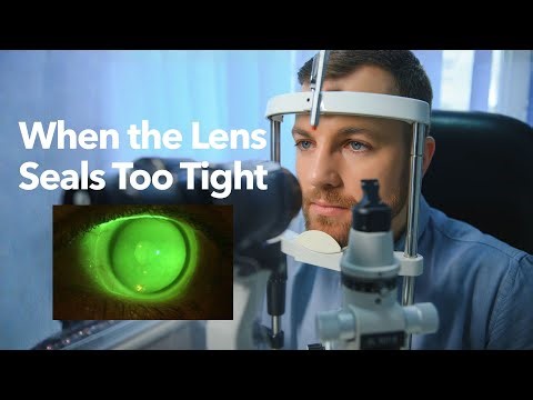 Lens Seal‑Off with Maxim 3D