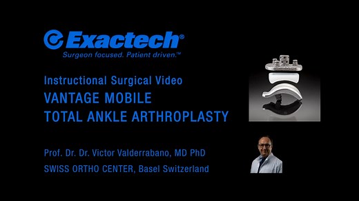 Vantage Total Ankle Mobile Bearing Surgical Video