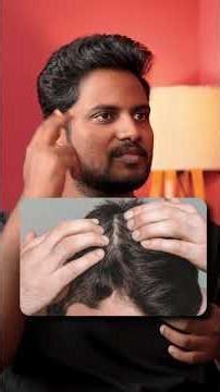 DHT & Hair Loss: What Really Kills Follicles? 😱💀