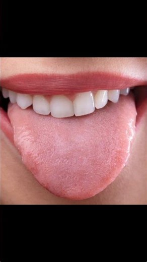 why your fingerprint are different from 8 billion+people s🙎‍♂️🙋‍♂️#facts#factsinhindi #viralshorts 🧐