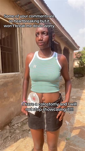 Living with a Colostomy: Empowering Stories and Care Tips