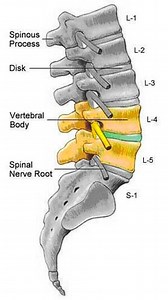 L4-L5 Disc Problem