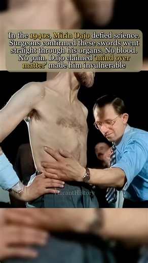 How Did He Survive? 1940s Science Left Speechless