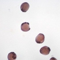Video: Flat Mount Preparation for Observation and Analysis of Zebrafish Embryo Specimens Stained by Whole Mount In situ Hybridization