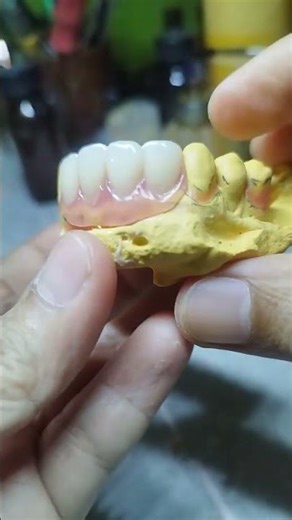 # Finished partial denture lower ordinary # you can watch my channel for more videos tanx