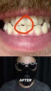 Photos that show the infinte power of time! 😱 #shorts