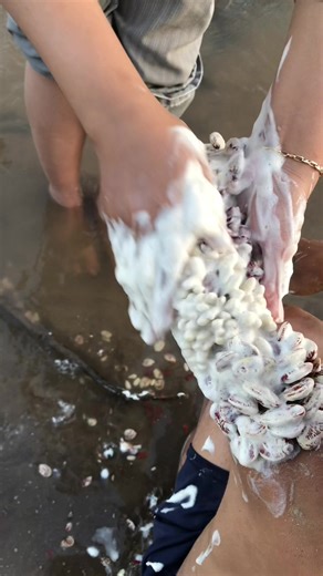 ticks stuck to my leg i was so scared and in so much pain #ticksremoval #removal #removals #trend #instalike #