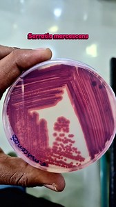 Did you know some bacteria can create their own vibrant colors? 🤯 I was just learning about *Serratia marcescens*, a super cool pigment-producing bacterium. It's amazing how nature can create such vivid shades, almost like tiny living artists! 🎨 These microorganisms can even produce a distinctive red pigment, which is pretty wild to think about. It just goes to show the incredible diversity and capabilities found in the microbial world all around us. Seriously, the more I learn, the more I'm b