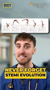 Easily recall STEMI evolution on an ECG