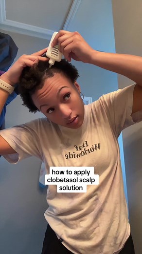 how to apply clobetasol propionate scalp solution! any questions feel free to leave them below :) #4c #4chair #4ctiktok #naturalhair #texturedhair #texturedhaircare #curlyhair #coilyhair #hairloss #clobetasol