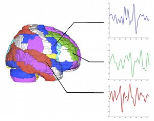 Temporal Order-based First-Take-All Hashing for Fast Attention-Deficit-Hyperactive-Disorder Detection | Proceedings of the 22nd ACM SIGKDD International Conference on Knowledge Discovery and Data Mining