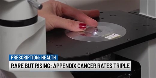 Rare But Rising: Appendix Cancer Rates Triple