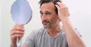 Com que idade a calvície começa nos homens? Usar boné causa queda de cabelos?