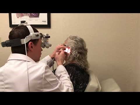 Micro Suction Cerumen (Ear Wax) Removal Procedure