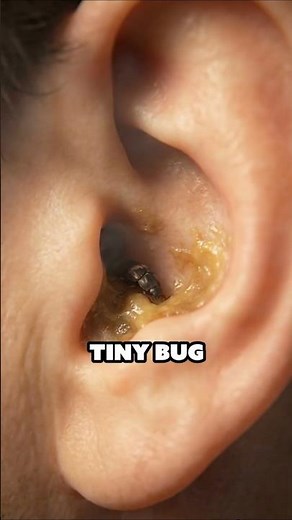 What Happens If A Bug Crawls In Your Ear… 😳