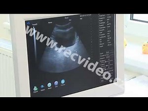 ČR - zdravotnictví - urologie - vyšetření močového měchýře - sonda