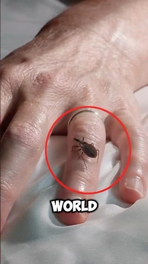 The Most Painful Sting In The World! 😱