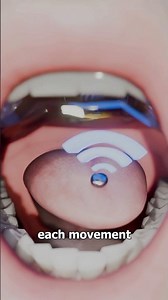 How A Tongue Can Drive A Wheelchair 😮 Surgeon Reacts