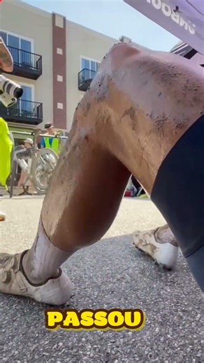 Parece algo vivo na perna dele 😳