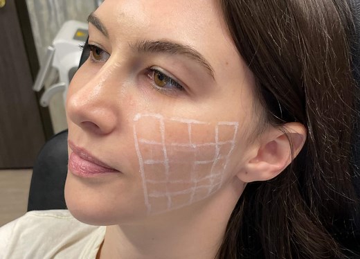 I Got Skinvive—and I Have Proof That It Made My Skin Younger