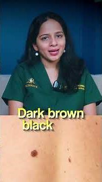 Common Skin Growths Explained by a Dermatologist