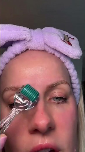 HOW TO GET RID OF 11 LINES BETWEEN YOUR BROWS