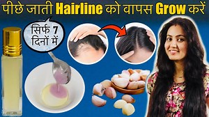 2.6M views · 35K reactions | 7 Days Challenge : गायब होती HAIRLINE को दोबारा उगाने के आसान तरीके | Grow Receding Hairline 100%❤️ | Preityप्रेरणा | Facebook