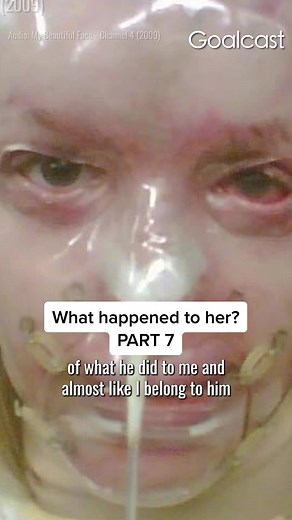 Replying to @Goalcast What happened to Katie Piper? 😨 #KatiePiper #katiepiperbreakfastshow #motivationalspeeches #motivationalwords #motivation #fy #fyp