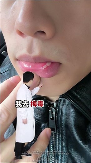 这些症状都是梅毒，千万别弄错了！#梅毒 #梅毒性脱发 #梅毒的症状 #传染 #医学科普