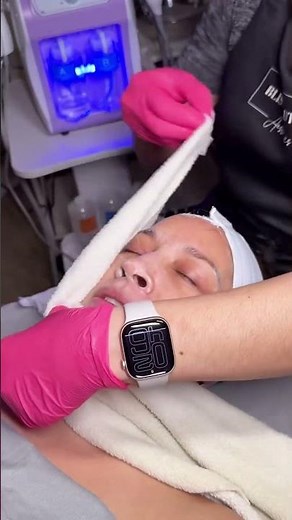 Watch This Deep Pore Cleansing! Ultrasonic Skin Scrubber in Action 🔥