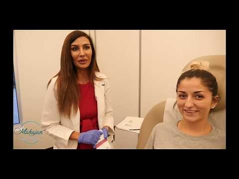 Non-Surgical Lip Augmentation with Juvederm Volbella XC