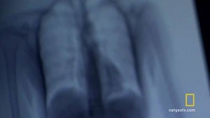 44K views · 379 reactions | This X-ray machine in El Dorado Airport, Colombia scans internal organs to detect if a person has swallowed drug capsules. But will it catch anything in this suspected drug smuggler's body? | National Geographic TV | Facebook