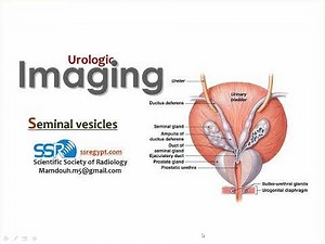 9 Seminal vesicles imaging TEC Prof Mamdouh Mahfouz