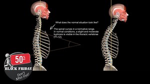 Learn to Identify Common Postural Disorders & Much More! Celebrate Black Friday with Massive Savings! 50% Off All Muscle & Motion Apps! | Muscle and Motion