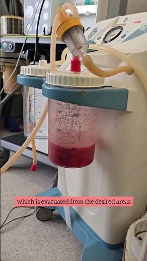 High-Definition Liposuction for Back Fat | Back Roll Correction & Body Sculpting Results