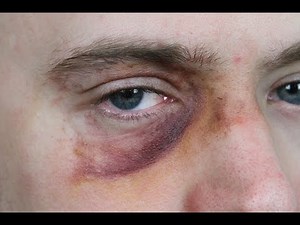 How to Make a Black Eye with Makeup