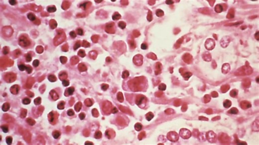 What is the hantavirus?