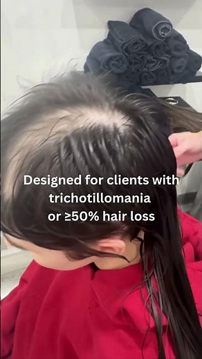 Meshless Hair Integration for Trichotillomania & Advanced Hair Loss
