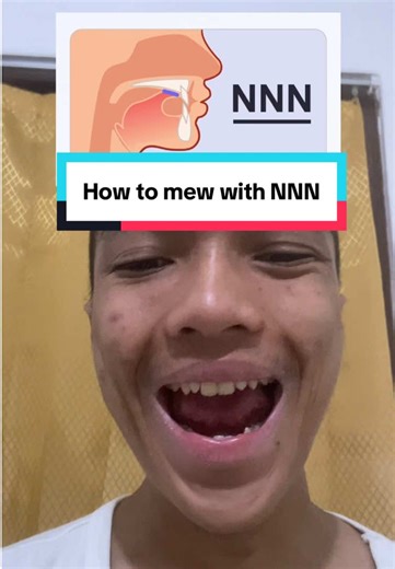 How to Mew for Correcting Tongue Posture