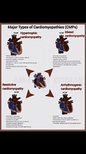 17K views · 308 reactions | Cardiomyopathies Decoded: Quick Guide...