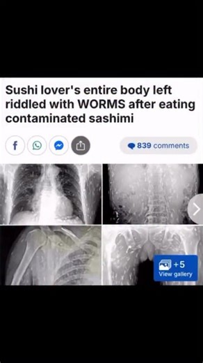 33 reactions · 18 shares | 3 Main Types if Parasites 裂protozoa,...