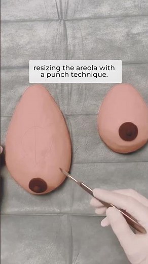 Breast Reduction Surgery Explained: What Really Happens Step by Step | clinic utoquai