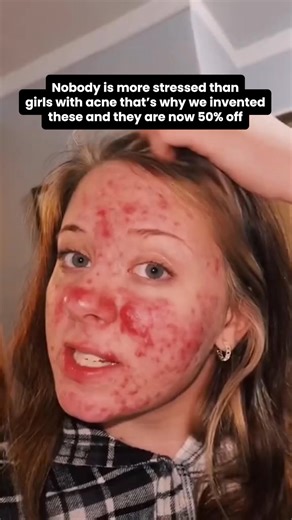 This Dermatologist-approved, clinically proven skin secret is on sale! Clinically proven benefits: ✨ Improves skin barrier ✨ Reduces redness ✨ Locks in hydration ✨ Boosts overall skin health As seen in: Vogue, Cosmopolitan, The Today Show, Good Morning America, CNN, InStyle & more! 🏆 2024 Dermascope Aesthetician's Choice Award 🏆 2022 Cosmopolitan Holy Grail Beauty Award 🏆 2024 New Beauty Readers' Choice Award There's a reason it's gone viral on TikTok... 🔥 *Results may vary. | Clean Skin Clu