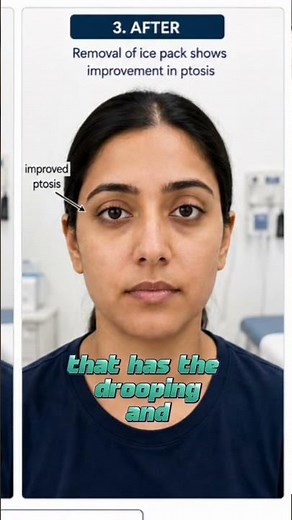 A Nurse Explains Diagnosing Myasthenia Gravis