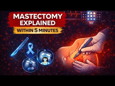 Mastectomy Explained in 5 Minutes | Types, Complications & Physiotherapy Management